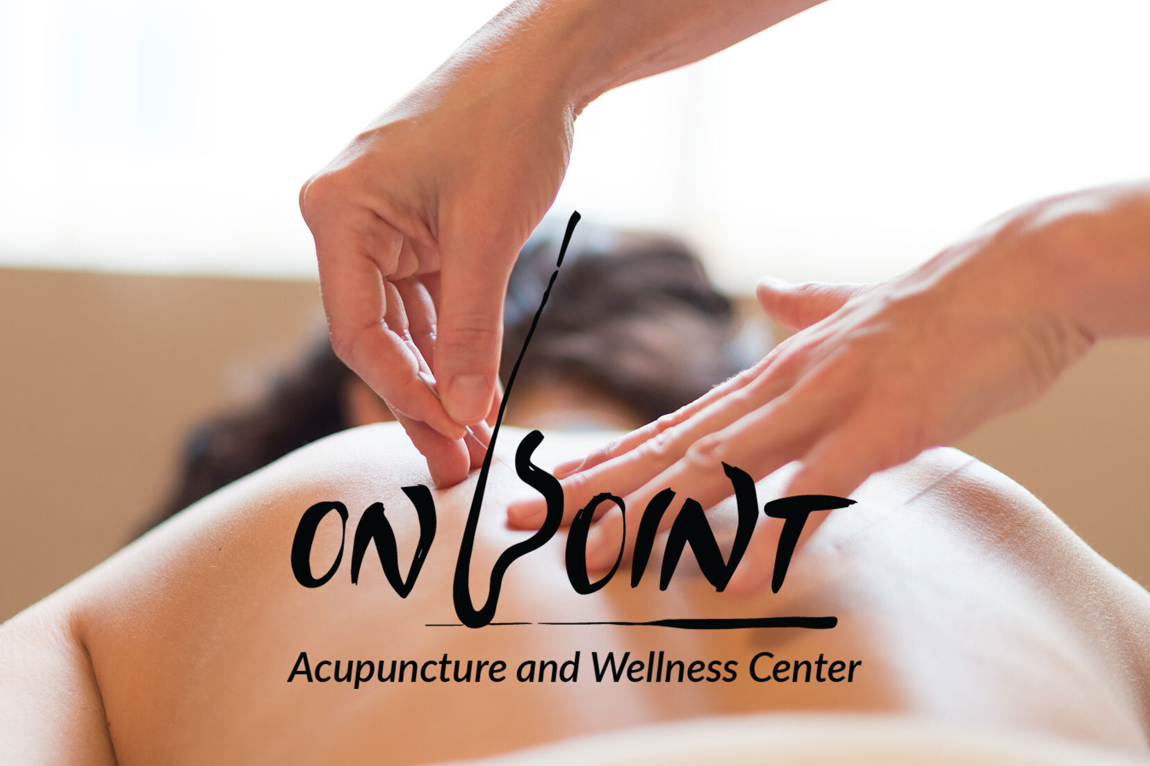 On Point branded service image — acupuncture in a warm, calm treatment room